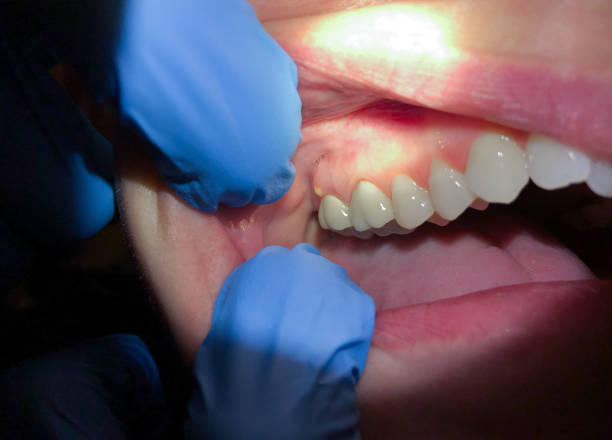 Best Broken or Cracked Tooth Emergency Dentist in Mead Valley, CA