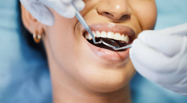 Best Emergency Dental Extractions in Mead Valley, CA